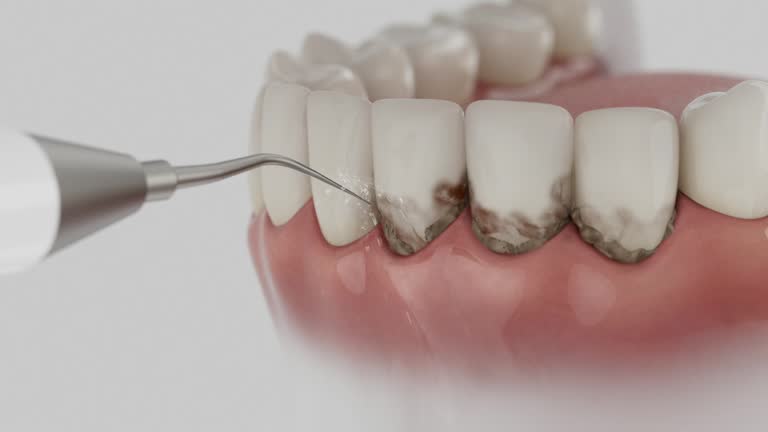 Reliable Tooth Extraction contractor in Platte County County, MO by Dentist Open Now